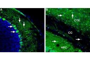 Expression of Ferroportin in mouse brain - Immunohistochemical staining of mouse cerebellum and forebrain using Anti-Ferroportin (SLC40A1) Antibody (ABIN7043729, ABIN7044546 and ABIN7044547). (SLC40A1 antibody  (2nd Cytoplasmic Loop))