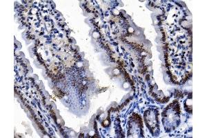 IHC analysis of TMS1/ASC/PYCARD using anti-TMS1/ASC/PYCARD antibody (ABIN7601174). (PYCARD antibody  (AA 3-193))