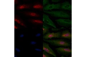ABIN6264434 and ABIN6277935 staining  cells by IF/ICC. (PRMT7 antibody  (Internal Region))