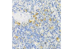 Immunohistochemistry of paraffin-embedded human tonsil using MLKL antibody (ABIN6134395, ABIN6143882, ABIN6143886 and ABIN6217454) at dilution of 1:100 (40x lens).