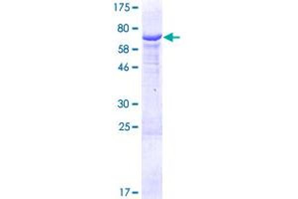 HSDL2 Protein (AA 1-418) (GST tag)