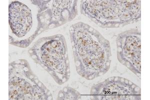 Immunoperoxidase of monoclonal antibody to ASAH1 on formalin-fixed paraffin-embedded human small Intestine. (ASAH1 antibody  (AA 25-124))