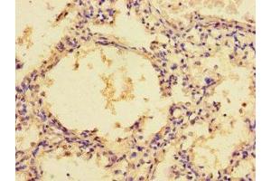 Immunohistochemistry of paraffin-embedded human lung tissue using ABIN7176741 at dilution of 1:100 (ZG16 antibody  (AA 17-167))