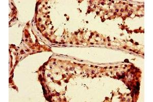 Immunohistochemistry of paraffin-embedded human testis tissue using ABIN7164097 at dilution of 1:100 (PRDM4 antibody  (AA 301-500))