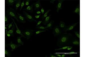 Immunofluorescence of monoclonal antibody to FBXL19 on HeLa cell. (FBXL19 antibody  (AA 365-472))