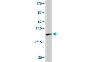 Western Blot detection against Immunogen (38. (SPI1 antibody  (AA 1-120))