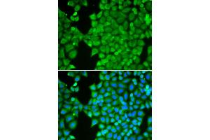 Immunofluorescence analysis of HeLa cells using CA3 antibody.