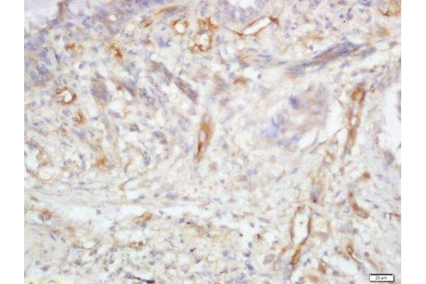 TRIB2 antibody  (AA 151-250)