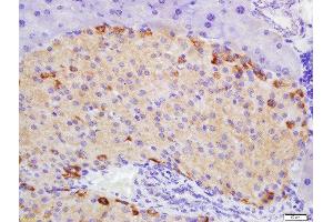 Formalin-fixed and paraffin embedded mouse pancreas labeled with Rabbit Anti-ATG1/ULK1 Polyclonal Antibody, Unconjugated 1:200 followed by conjugation to the secondary antibody and DAB staining (ULK1 antibody  (AA 951-1050))
