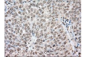 Immunohistochemical staining of paraffin-embedded Human colon tissue using anti-ACAT2 mouse monoclonal antibody. (ACAT2 antibody)