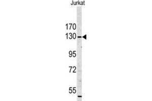Western Blotting (WB) image for anti-Myosin IA (MYO1A) antibody (ABIN3003156) (Myosin IA antibody)