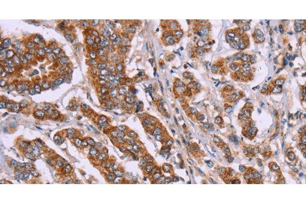 DCTN6 antibody