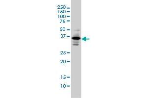 PITX1 monoclonal antibody (M01), clone 5G4 Western Blot analysis of PITX1 expression in Hela S3 NE . (PITX1 antibody  (AA 225-313))