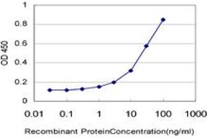 Detection limit for recombinant GST tagged LASS4 is approximately 0. (LASS4 antibody  (AA 57-139))