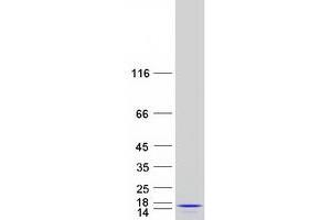 Mitochondrial Ribosomal Protein L53 (MRPL53) protein (Myc-DYKDDDDK Tag)