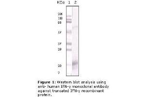 Image no. 1 for anti-Interferon gamma (IFNG) antibody (ABIN207597) (Interferon gamma antibody)