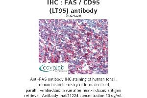 Image no. 1 for anti-TNF Receptor Superfamily, Member 6 (FAS) antibody (ABIN1724054) (FAS antibody)