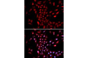 Immunofluorescence analysis of U2OS cells using KPNA4 antibody (ABIN5971058).