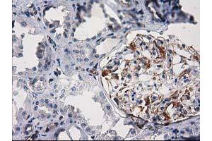 Immunohistochemical staining of paraffin-embedded Human Kidney tissue using anti-PDE2A mouse monoclonal antibody. (PDE2A antibody)