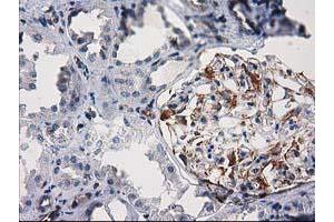 Immunohistochemical staining of paraffin-embedded Human Kidney tissue using anti-PDE2A mouse monoclonal antibody.