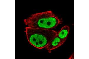 Immunofluorescent staining of human cell line PC-3 with RARG polyclonal antibody  at 1-4 ug/mL concentration shows positivity in nucleus but excluded from the nucleoli. (Retinoic Acid Receptor gamma antibody)