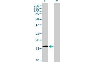 Western Blot analysis of CLUHP3 expression in transfected 293T cell line ( H00079014-T02 ) by CLUHP3 MaxPab polyclonal antibody. (CLUHP3 antibody  (AA 1-147))