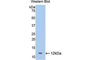 Western blot analysis of the recombinant protein. (OAS1 antibody  (AA 74-165))