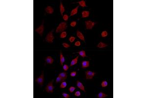 Immunofluorescence analysis of A-549 cells using MMP7 Rabbit pAb (ABIN3021102, ABIN3021103, ABIN3021104, ABIN1513214 and ABIN6213952) at dilution of 1:350 (40x lens).