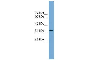 WB Suggested Anti-CCDC117 Antibody Titration: 0. (CCDC117 antibody  (Middle Region))