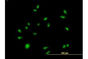 Immunofluorescence of purified MaxPab antibody to CEBPZ on HeLa cell.