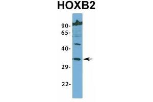 Host:  Rabbit  Target Name:  HOXB2  Sample Type:  Jurkat  Antibody Dilution:  1. (HOXB2 antibody  (N-Term))