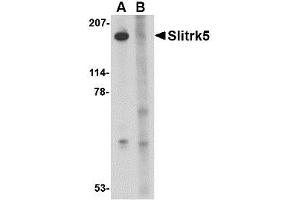 Image no. 1 for anti-SLIT and NTRK-Like Family, Member 5 (SLITRK5) (Internal Region) antibody (ABIN1493808) (SLITRK5 antibody  (Internal Region))