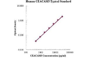 ELISA image for Carcinoembryonic Antigen-Related Cell Adhesion Molecule 5 (CEACAM5) ELISA Kit (ABIN3199206)