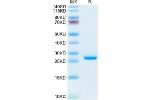 CRP Protein (AA 20-225) (His tag)