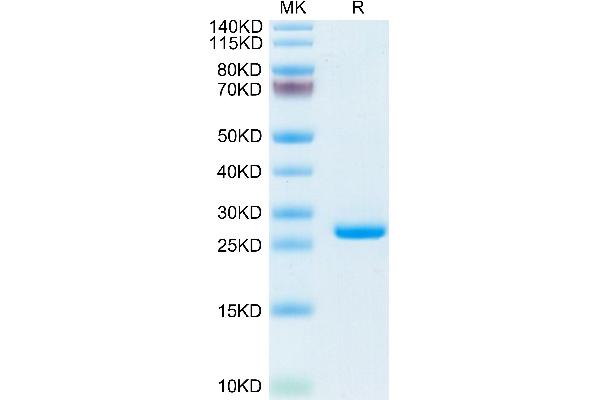 CRP Protein (AA 20-225) (His tag)