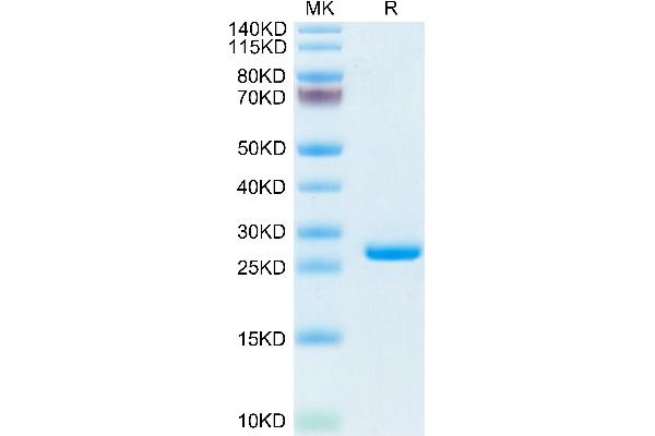 CRP Protein (AA 20-225) (His tag)