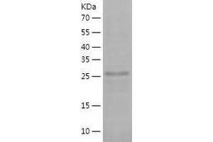 Western Blotting (WB) image for Phosphatidylinositol Transfer Protein, Membrane-Associated 2 (PITPNM2) (AA 162-435) protein (His tag) (ABIN7124404)