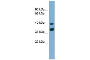 GPN2 antibody used at 1 ug/ml to detect target protein.