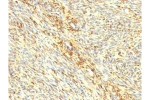 Formalin-fixed, paraffin-embedded human uterus stained with Transglutaminase 2 antibody. (Transglutaminase 2 antibody)