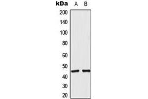 Western blot analysis of ACOT4 expression in RT4 (A), A549 (B) whole cell lysates. (ACOT4 antibody  (C-Term))