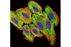 Immunofluorescence analysis of HepG2 cells using CCL2 mouse mAb (green). (CCL2 antibody)