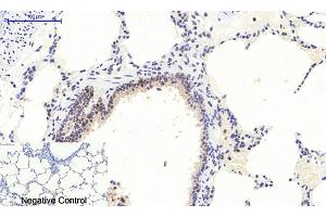 Immunohistochemical analysis of paraffin-embedded rat lung tissue. (ERK1/2 antibody  (pThr202))