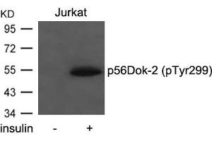 Western blot analysis of extracts from Jurkat cells untreated or treated with insulin using p56Dok-2(Phospho-Tyr299) Antibody.