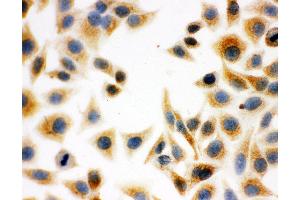 Anti-DCI antibody, ICC ICC: HELA Cell (DCI antibody  (C-Term))