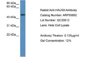 WB Suggested Anti-HAUS8  Antibody Titration: 0. (NYS48/HAUS8 antibody  (N-Term))