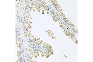 Immunohistochemistry of paraffin-embedded human prostate using PPP3R1 antibody at dilution of 1:100 (x40 lens). (PPP3R1 antibody)