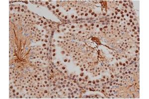 ABIN6267333 at 1/200 staining Mouse testis tissue sections by IHC-P. (SP1 antibody  (pThr453))
