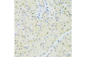 Immunohistochemistry of paraffin-embedded rat pancreas using BRCA1 antibody (ABIN6291827) at dilution of 1:100 (40x lens). (BRCA1 antibody)