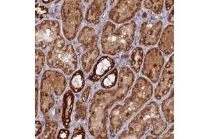 Immunohistochemical staining of human kidney with MPV17L polyclonal antibody  shows strong cytoplasmic positivity in tubular cells.