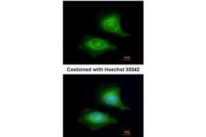 ICC/IF Image Immunofluorescence analysis of methanol-fixed HeLa, using LZTFL1, antibody at 1:200 dilution. (LZTFL1 antibody)